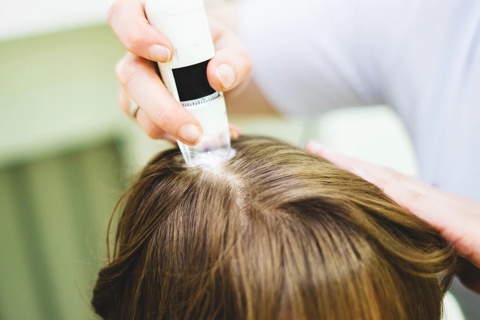 Femme examinant sa racine des cheveux et son cuir chevelu, mains protectrices autour de sa tête