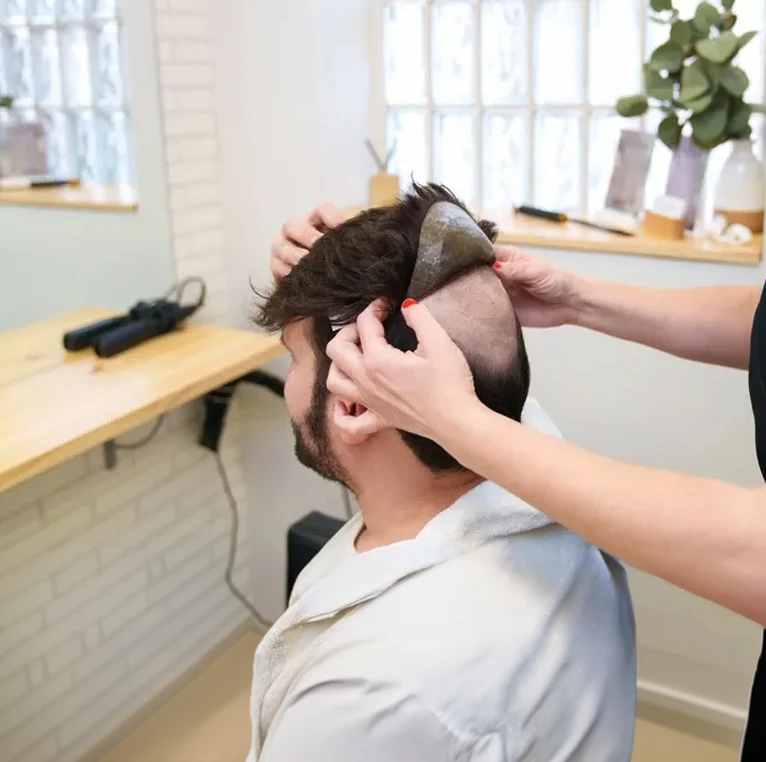 Examen capillaire professionnel en cours, praticien portant gants latex blancs utilisant loupe grossissante pour analyser cuir chevelu et follicules pileux sur patient aux cheveux châtains