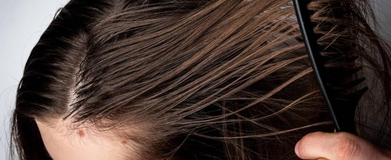 Cheveux gras : causes et solutions